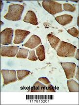 CCDC85B Antibody
