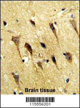WBP2 Antibody