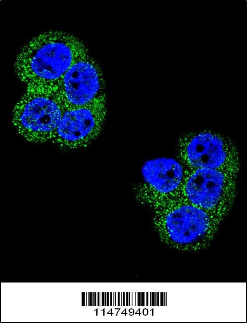 PDGFRB Antibody