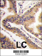 MAPK13 Antibody