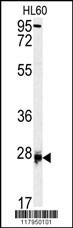 DPT Antibody