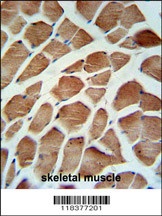 CA5B Antibody