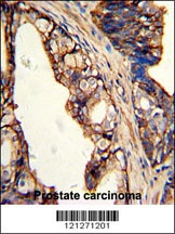 TGM4 Antibody