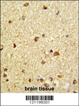 CBFB Antibody