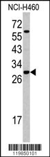 SRSF5 Antibody