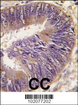 ST13 Antibody