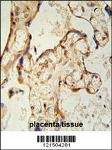 PON2 Antibody