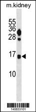 FUNDC2 Antibody