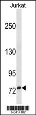 ZNF274 Antibody