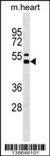 Il12b Antibody