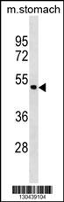ANXA10 Antibody