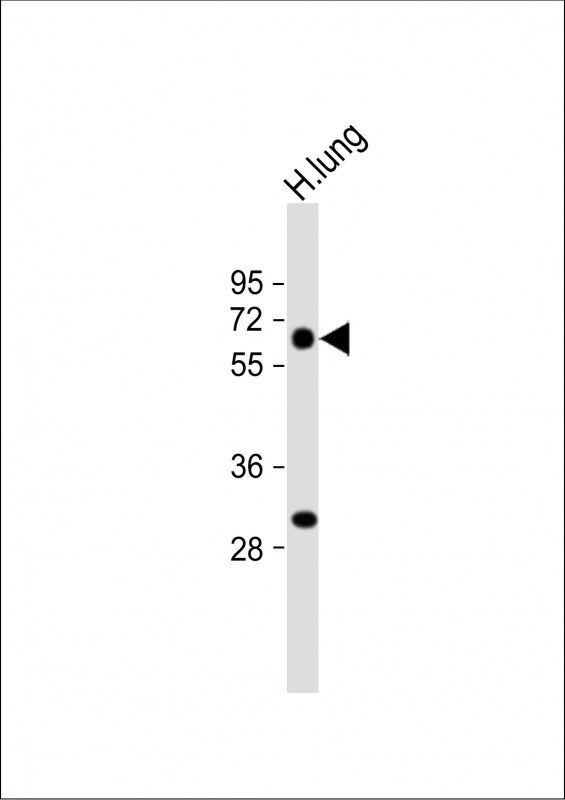 CALCRL Antibody