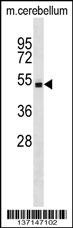 Stk4 Antibody