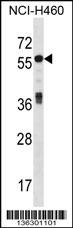 ICA1 Antibody