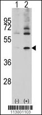 ACTC1 Antibody
