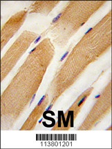 ACTC1 Antibody