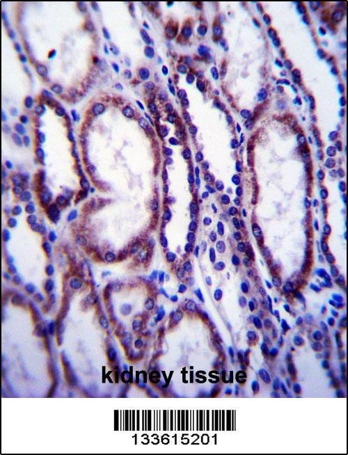 COL1A1 Antibody