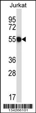 CNOT2 Antibody