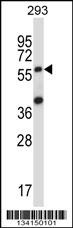SOCS6 Antibody