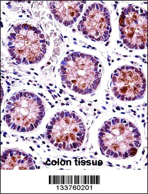 HEXIM1 Antibody