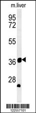 TRAF1 Antibody