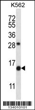 SCGB1D2 Antibody