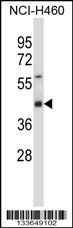 SYT1 Antibody