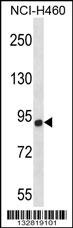 CHSY1 Antibody