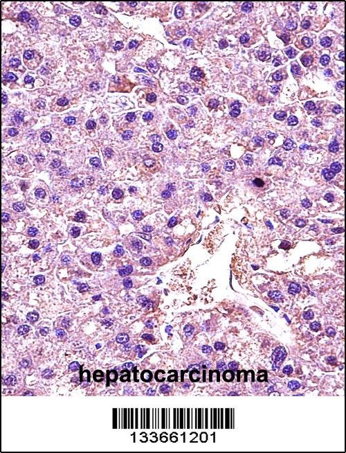 LDHA Antibody