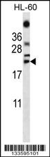 TNF Antibody
