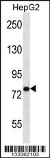 USP45 Antibody