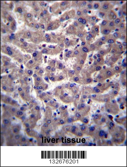 PTGR2 Antibody