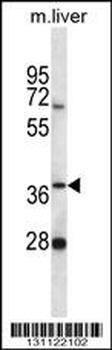 PNKD Antibody