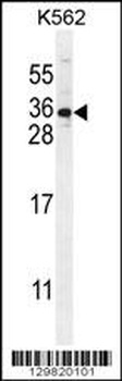 STARD6 Antibody