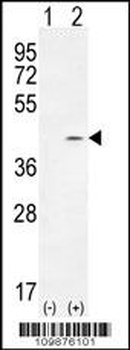 TWF2 Antibody