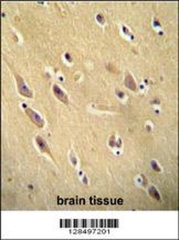 CYB561D1 Antibody