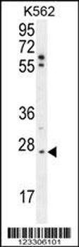 TNFAIP8 Antibody