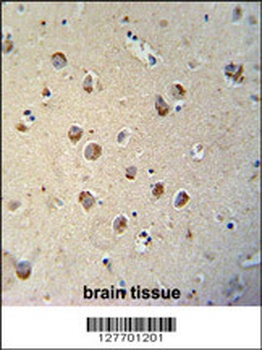 TECTB Antibody