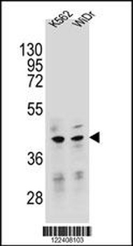 TFB2M Antibody