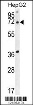 ACOT11 Antibody
