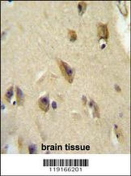 APOL6 Antibody