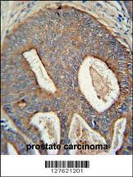 POTEB Antibody