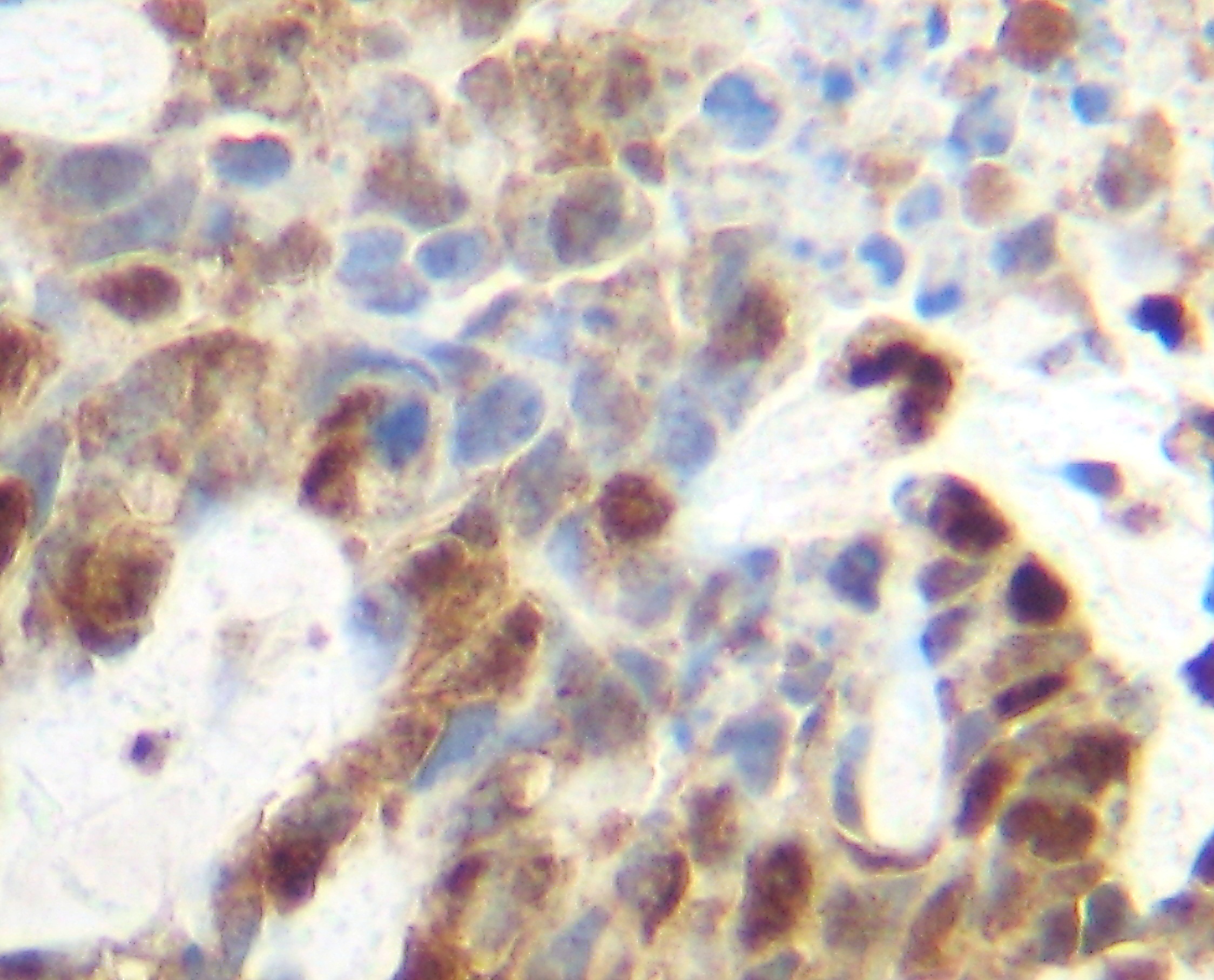 TNF Antibody