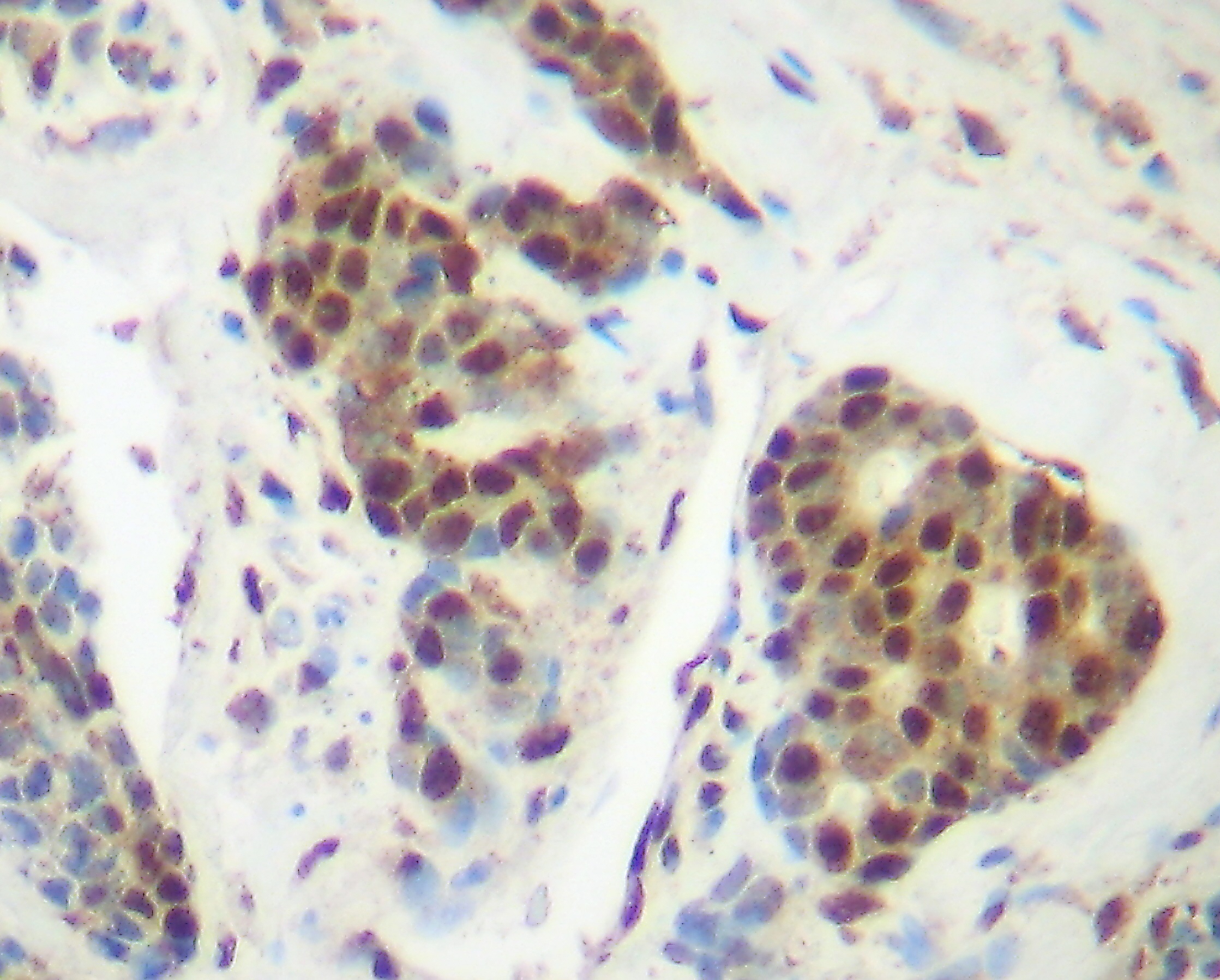 TNF Antibody