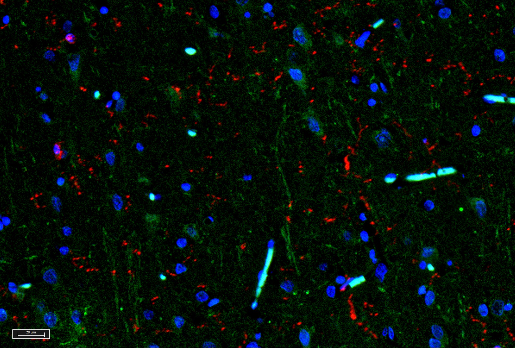 IL11 Antibody