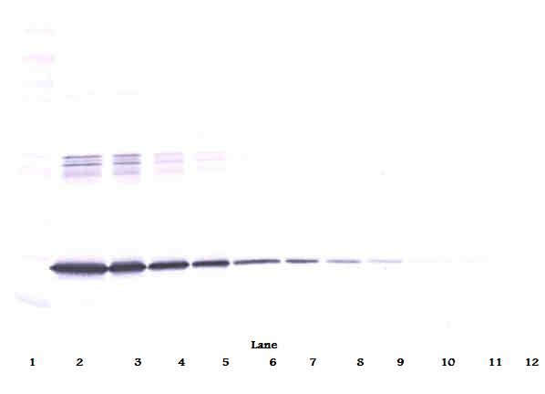 IL6 Antibody