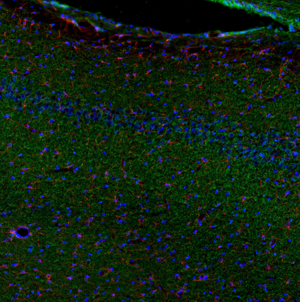 Tnf Antibody