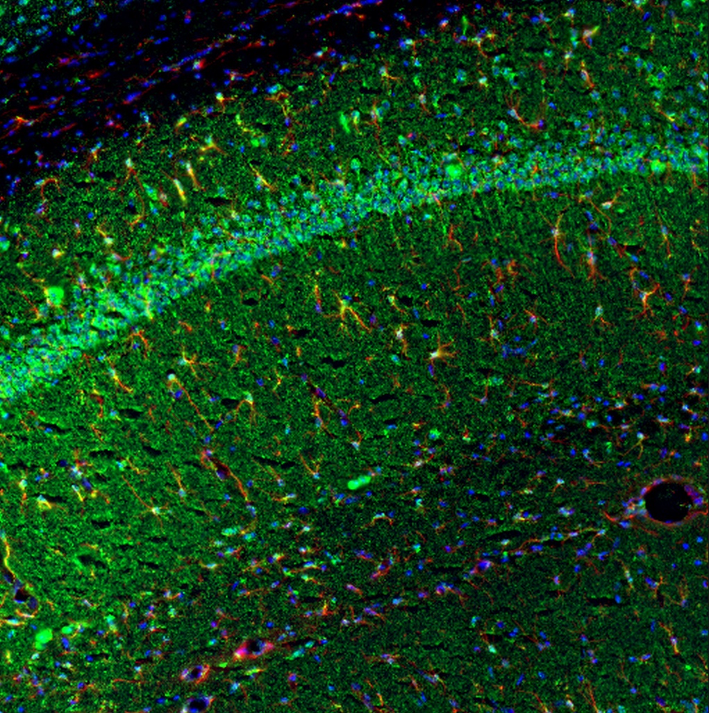 Tnf Antibody