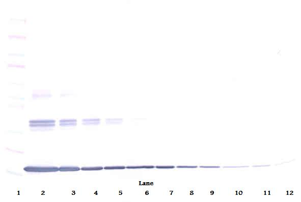 Tnf Antibody