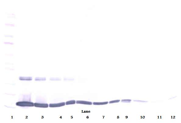 Tnf Antibody